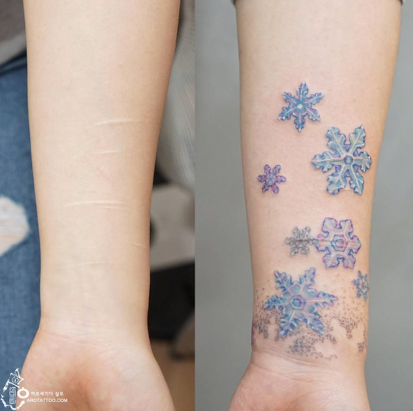 Scar-concealing snowflakes by Tattooist Silo