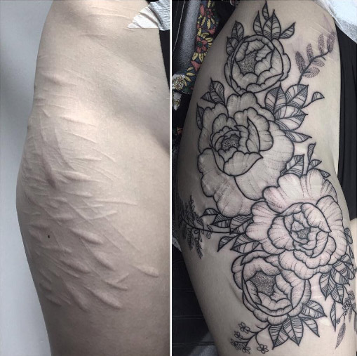 Floral scar-concealing thigh tattoo by Poppy Seger
